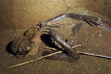 Early Iron Age blindfolded girl from Windeby Bog, Germany, Europe