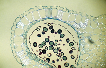 Light Micrograph (LM) of the transverse section of Dehiscence Lilium Anthers with pollen, magnification x300