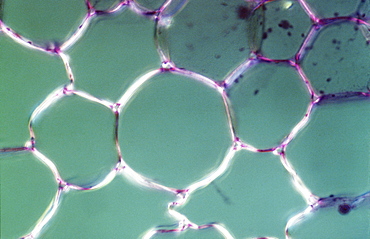 Light Micrograph (LM) of the transverse section showing Parenchyma or packing tissue from Cucurbita Stem, magnification x1200