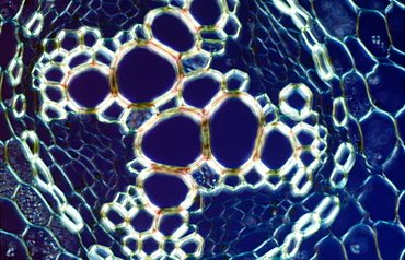 Light Micrograph (LM) of a transverse section showing xylem of root of Ranunculus repens (Creeping Buttercup)