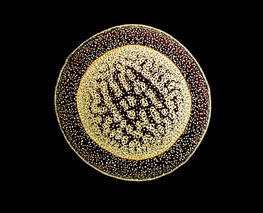 Light Micrograph (LM) of a transverse section of an aerial root of a Pandanus sp., magnification x30