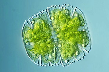 desmid alga desmid differential interference contrast microscopy DIC