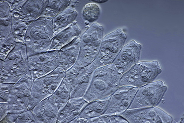 peritrichous ciliate stalked bell-shaped ciliates differential interference contrast microscopy DIC