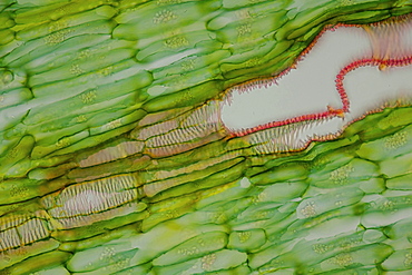 section root horseradish bright field microscopy