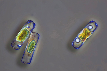 diatoms diatom phase contrast microscopy