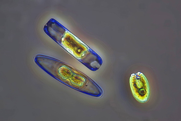 diatoms diatoms phase contrast microscopy