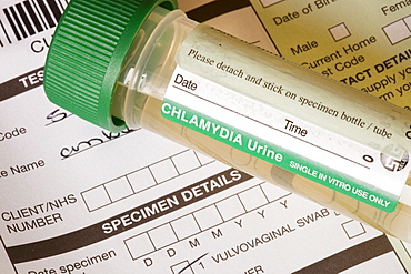 A Chlamydia self testing kit, United Kingdom, Europe