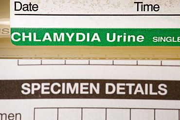 A Chlamydia self testing kit, United Kingdom, Europe