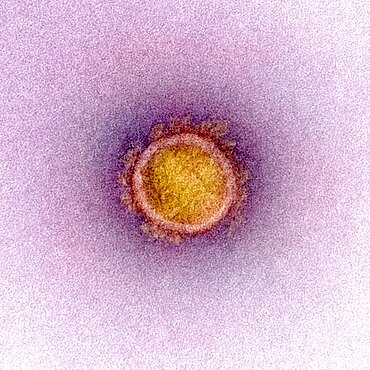 Novel coronavirus sars-cov-2