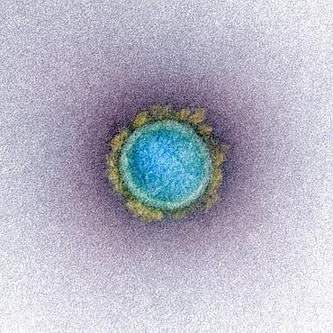 Novel coronavirus sars-cov-2