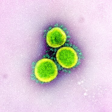 Novel coronavirus sars-cov-2