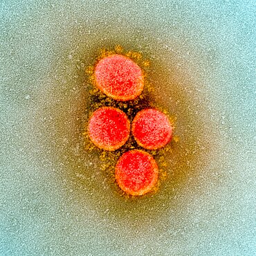 Novel coronavirus sars-cov-2