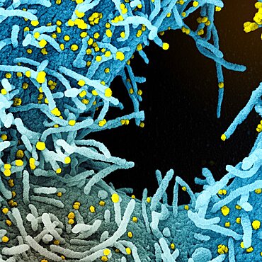 Novel coronavirus sars-cov-2