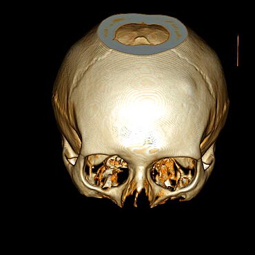 Skull, 3D Scan