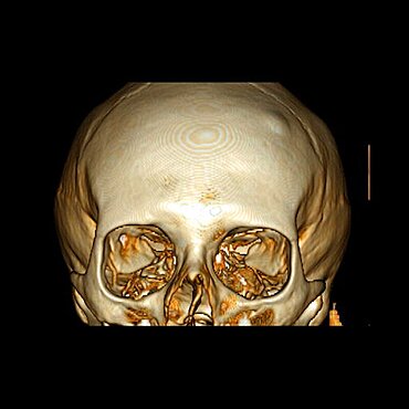 Skull, 3D Scan