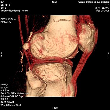 Knee, 3D Scan