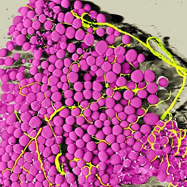 Fat Cells and Blood Vessels, SEM