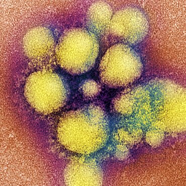 MERS-CoV, Coronavirus, TEM