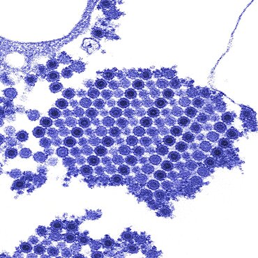 TEM of Chikungunya Virus