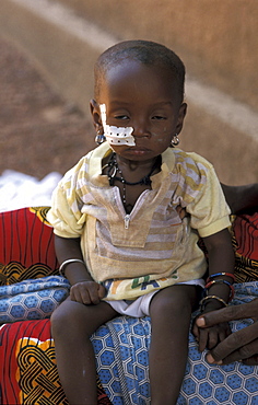 Burkina malnourished child attached nutrition center in ouagadougou