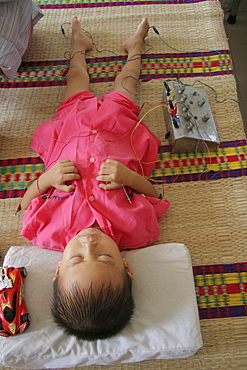 Vietnam child receiving acupuncture treatment at hospital in hanoi