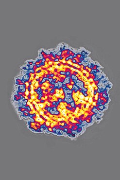 Coronavirus