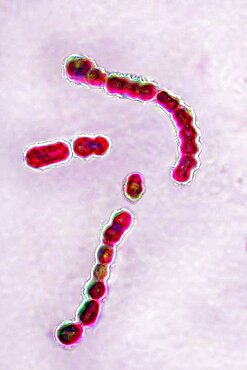 Streptococcus pyogenes