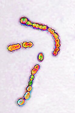 Streptococcus pyogenes