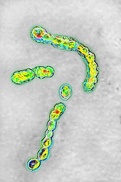 Streptococcus pyogenes