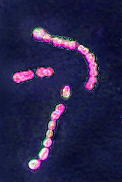 Streptococcus pyogenes