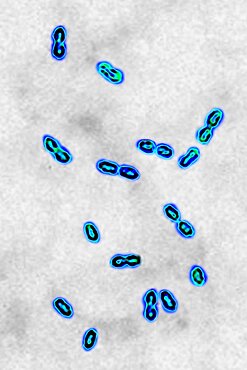 Pneumococcal bacteria