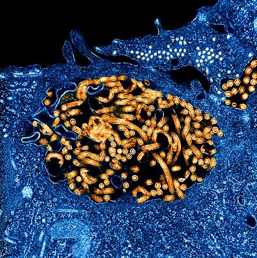 Ebola virus nucleocapsids and virus particles