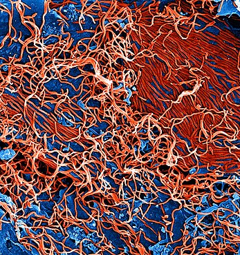 Ebola virus particles