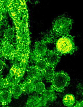 Mers-cov particles