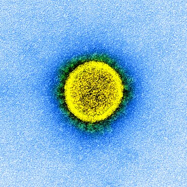 Novel coronavirus sars-cov-2