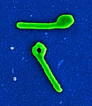 Two ebola virus particles