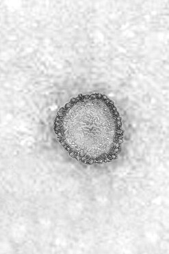 Coronavirus, virus of the family Coronaviridae and of the subfamily Orthocoronavirinae. View from a transmission electron microscopy (TEM) image