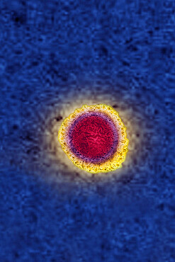 Coronavirus, virus of the family Coronaviridae and of the subfamily Orthocoronavirinae. View from a transmission electron microscopy (TEM) image