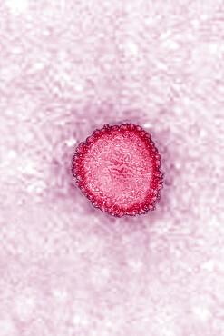 Coronavirus, virus of the family Coronaviridae and of the subfamily Orthocoronavirinae. View from a transmission electron microscopy (TEM) image