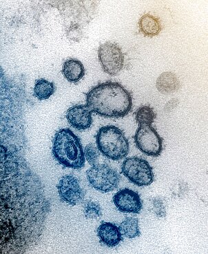 Coronavirus covid-19