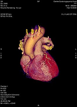 Heart, 3D Scan