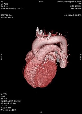 Heart, 3D Scan