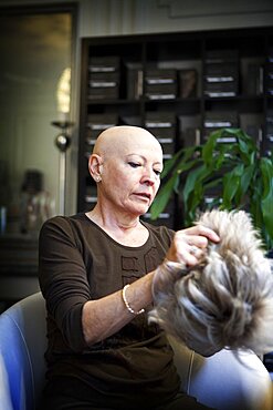 Alopecia, Woman