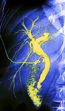 Cholangiography