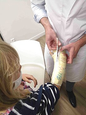 Doctor cutting the plaster with scissors of an 8-year-old girl on the wrist broken 6 weeks ago, European, France.