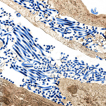 Ebola virus particles (blue) found both as extracellular particles and budding particles from chronically infected African green monkey kidney cells. Image captured and color-enhanced at the NIAID Integrated Research Facility in Ft. Detrick, Maryland.