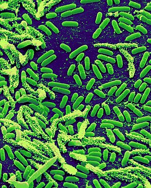 Vibrio Bacteria, SEM