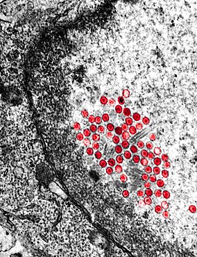 Herpes simplex 2 Virus, TEM