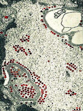 Herpes Simplex Virus, TEM