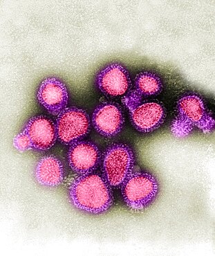 H3N2, Hong Kong Flu Virus, TEM